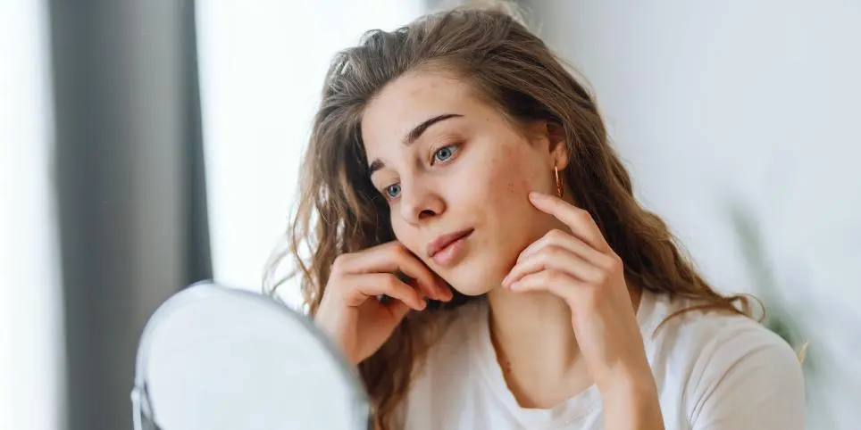 Kuidas valida meigitooteid aknele kalduvale nahale?