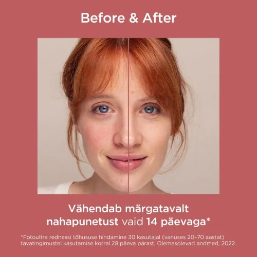 ISDIN SUN PÄIKSEKAITSELOSJOON PUNETAVALE NAHALE SPF50 50ML - Tootepilt 3